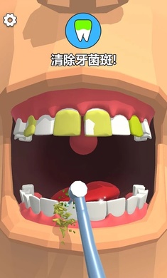 拔牙我最强